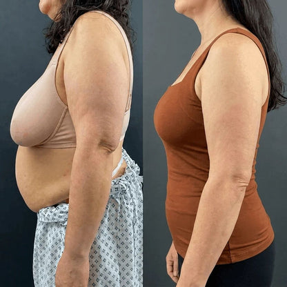 Dites adieu à votre soutien-gorge — sans rien perdre du maintien